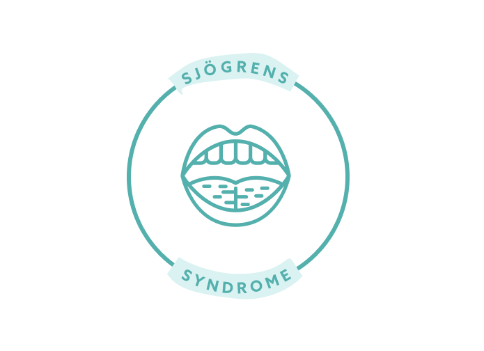 What is Sjögren’s Syndrome?